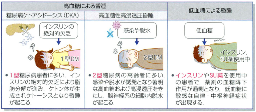 10代の1型糖尿病とは何ですか?